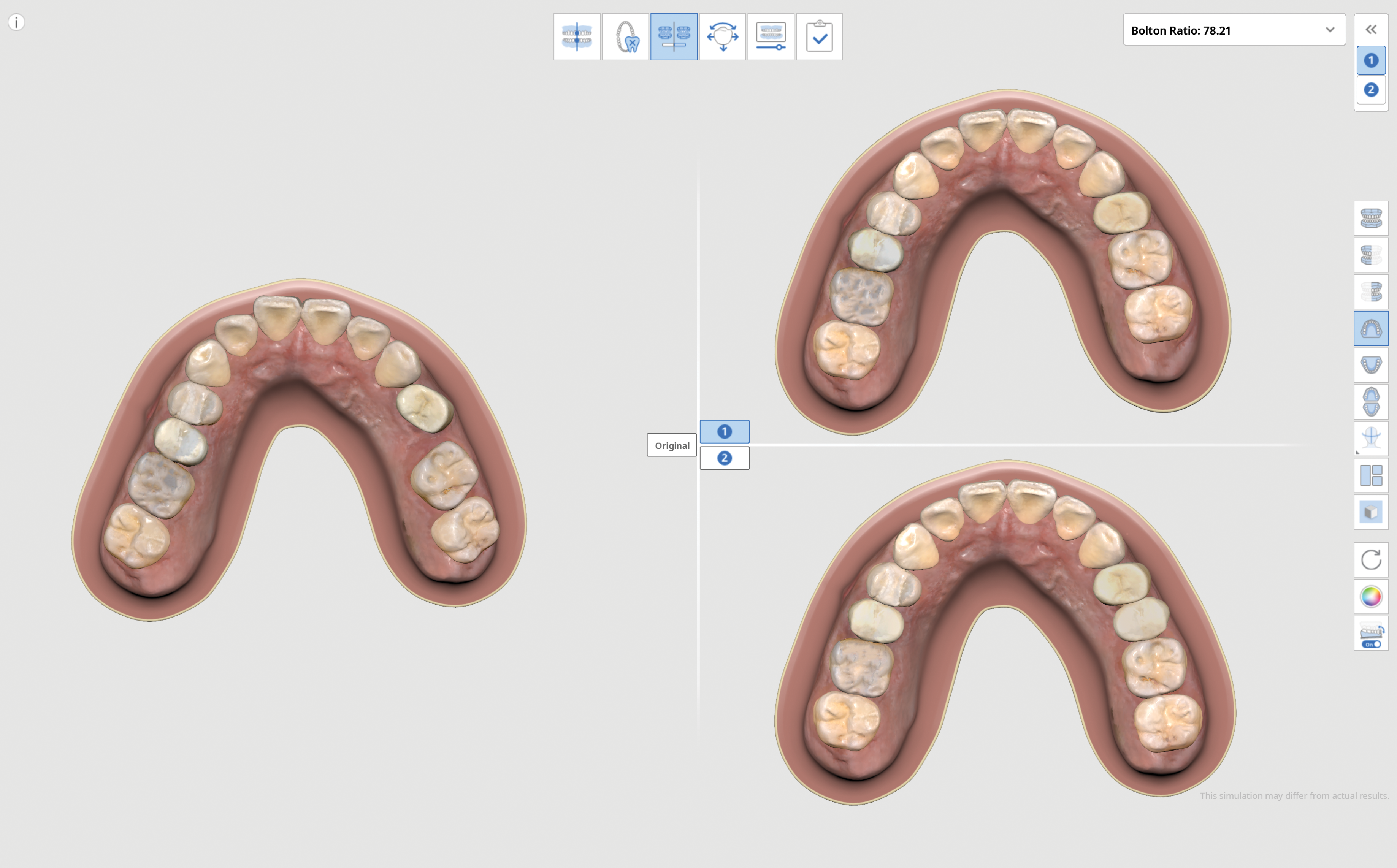Medit Ortho Simulation